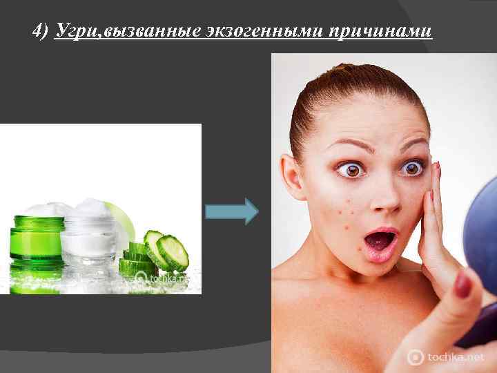 4) Угри, вызванные экзогенными причинами 