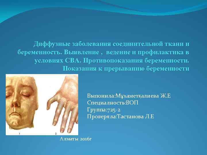 Диффузные заболевания соединительной ткани и беременность. Выявление , ведение и профилактика в условиях СВА.