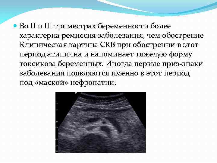  Во II и III триместрах беременности более характерна ремиссия заболевания, чем обострение Клиническая