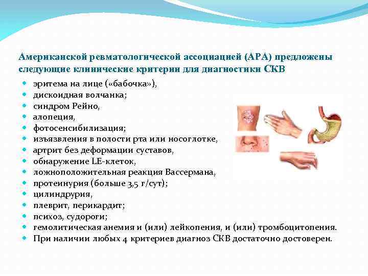 Американской ревматологической ассоциацией (АРА) предложены следующие клинические критерии для диагностики СКВ эритема на лице