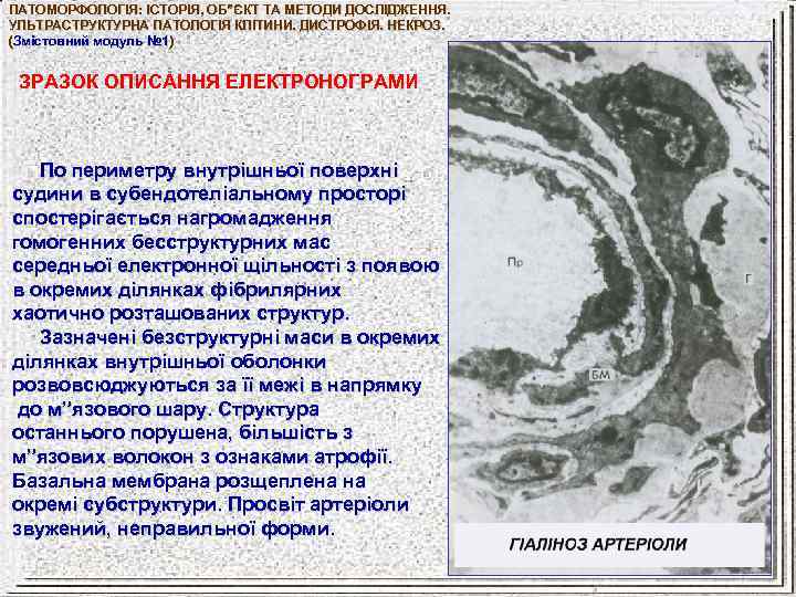 ПАТОМОРФОЛОГІЯ: ІСТОРІЯ, ОБ”ЄКТ ТА МЕТОДИ ДОСЛІДЖЕННЯ. УЛЬТРАСТРУКТУРНА ПАТОЛОГІЯ КЛІТИНИ. ДИСТРОФІЯ. НЕКРОЗ. (Змістовний модуль №