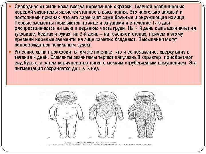  Свободная от сыпи кожа всегда нормальной окраски. Главной особенностью коревой экзантемы является этапность