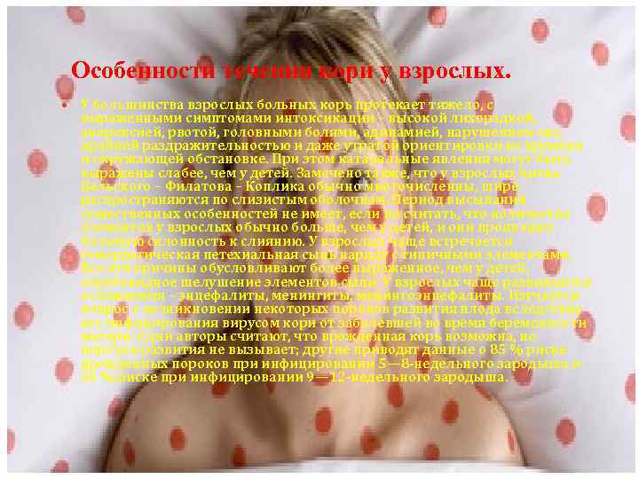 Особенности течения кори у взрослых. У большинства взрослых больных корь протекает тяжело, с выраженными