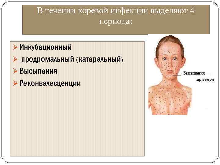 В течении коревой инфекции выделяют 4 периода: Ø Инкубационный Ø продромальный (катаральный) Ø Высыпания