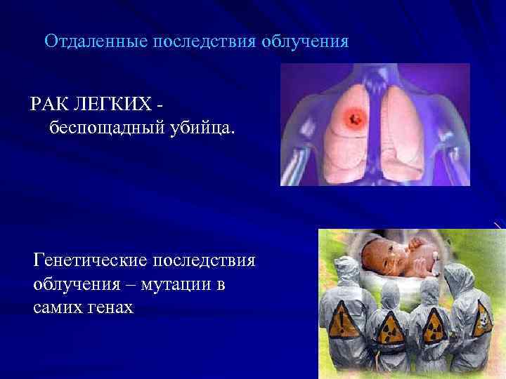 Отдаленные последствия облучения РАК ЛЕГКИХ беспощадный убийца. Генетические последствия облучения – мутации в самих