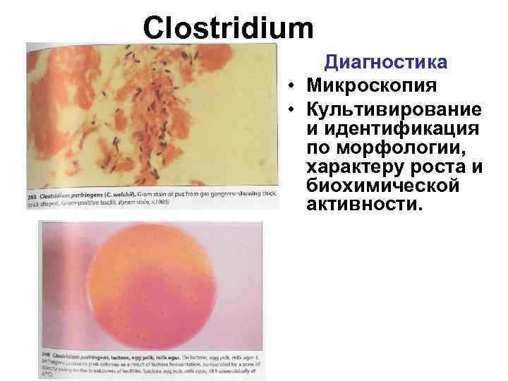 Clostridium Диагностика • Микроскопия • Культивирование и идентификация по морфологии, характеру роста и биохимической