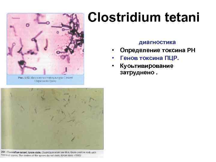 Определение токсинов а и в clostridium. Клостридиум перфрингенс возбудитель. Клостридии пропионикум. Токсин в клостридий в Кале. Clostridium perfringens диагностика.