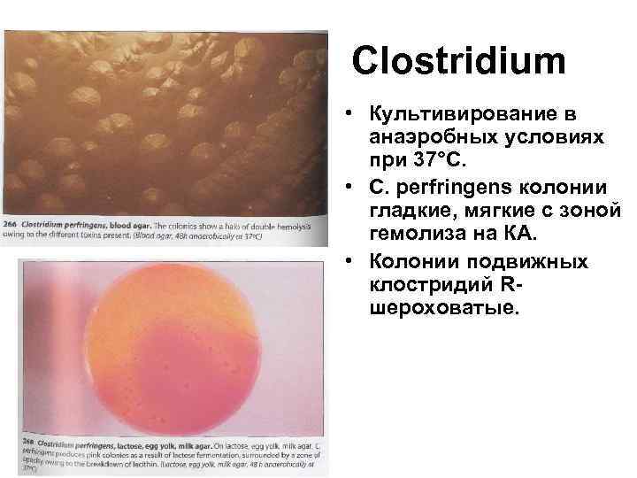 Кал на токсины клостридии диффициле