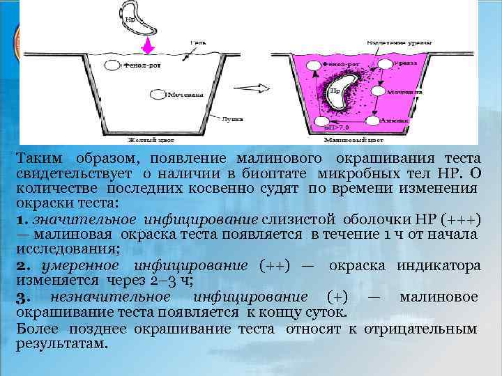 Таким образом, появление малинового окрашивания теста свидетельствует о наличии в биоптате микробных тел НР.