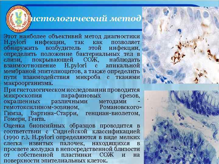Гистологический метод Этот наиболее объективнй метод диагностики Н. pylori инфекции, так как позволяет обнаружить