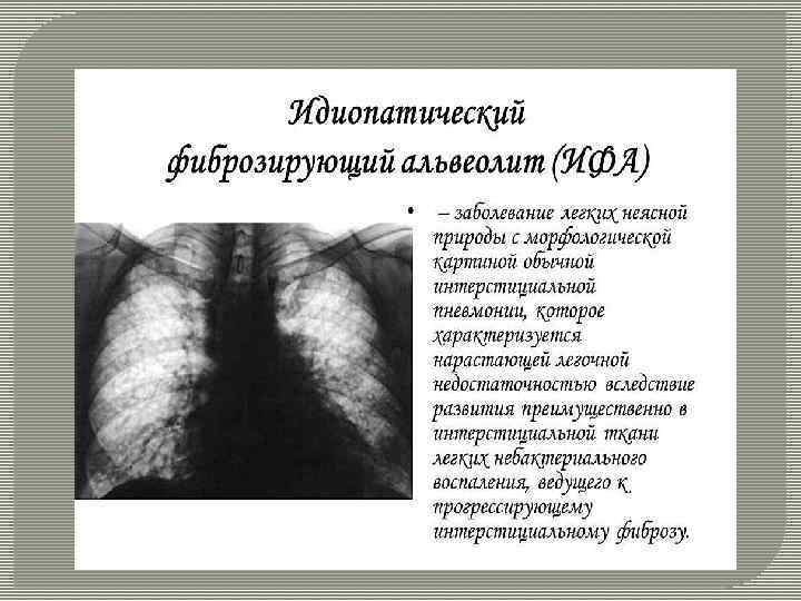 Фиброзирующий альвеолит у детей презентация
