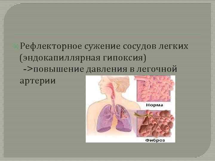 Фиброзирующий альвеолит у детей презентация