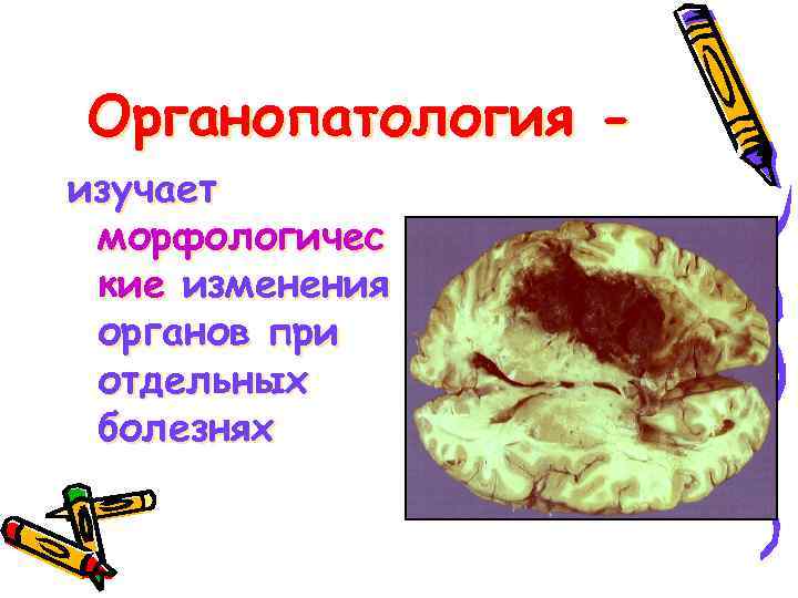 Органопатология изучает морфологичес кие изменения органов при отдельных болезнях 