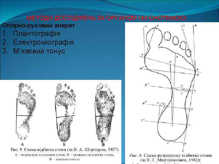 МЕТОДИ ДОСЛІДЖЕНЬ ЗА ОРГАНОМ ЧИ СИСТЕМОЮ: Опорно-руховий апарат 1. Плантографія 2. Електроміографія 3. М’язевий