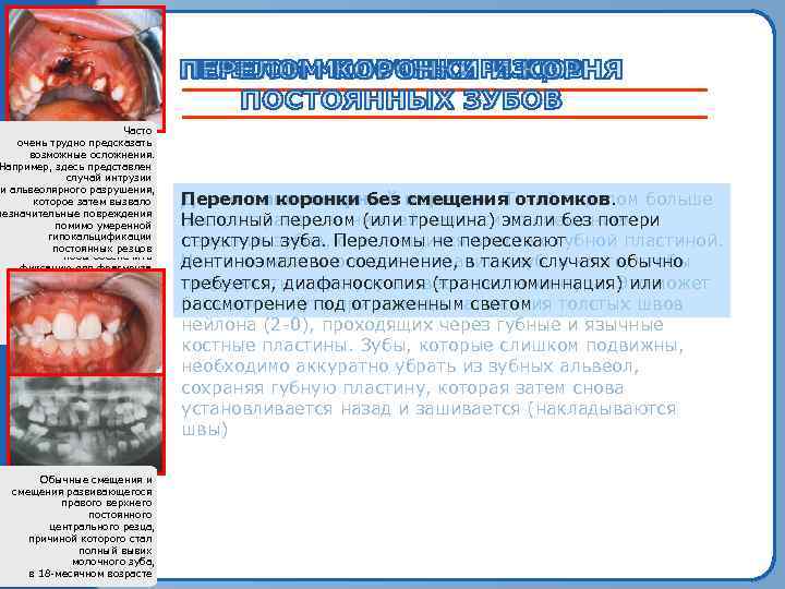 Зубочелюстной перелом Часто у 6 -месячного ребенка. очень трудно предсказать В осложнения. возможныеэтих случаях