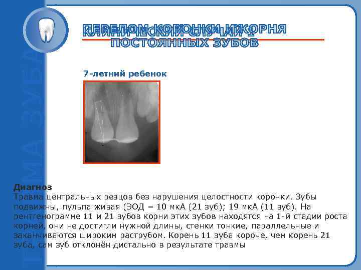 7 -летний ребенок Пробный текст Диагноз Травма центральных резцов без нарушения целостности коронки. Зубы