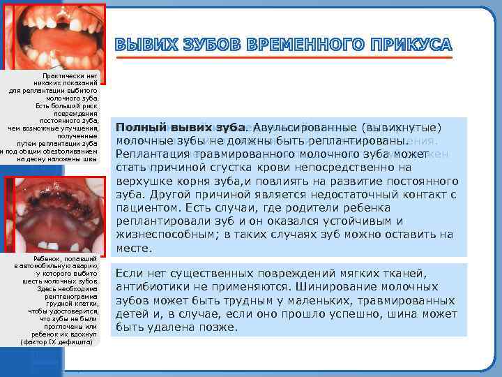 Практически нет Макроскопическое смещение никаких показаний всех верхних для реплантации выбитого передних зубов молочного