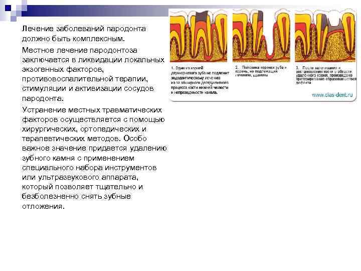 Лечение заболеваний пародонта должно быть комплексным. Местное лечение пародонтоза заключается в ликвидации локальных экзогенных