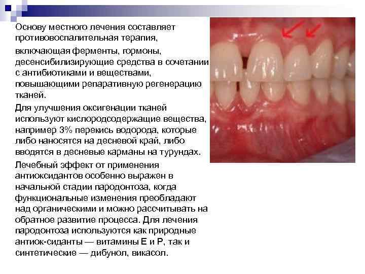 Основу местного лечения составляет противовоспалительная терапия, включающая ферменты, гормоны, десенсибилизирующие средства в сочетании с