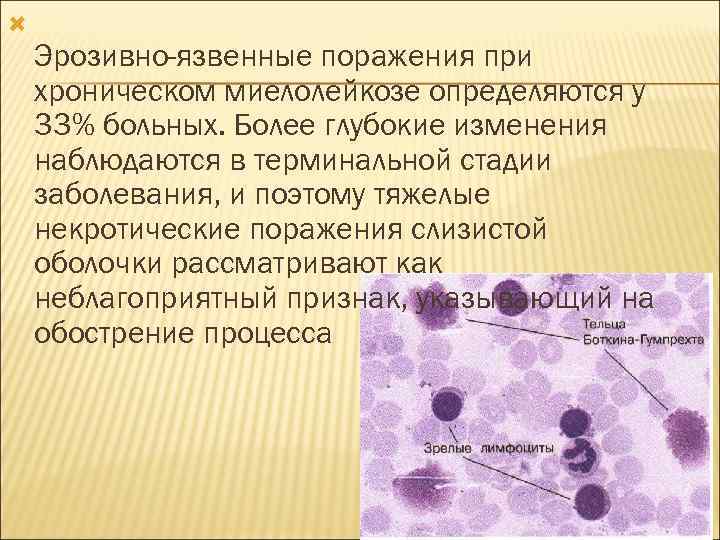  Эрозивно-язвенные поражения при хроническом миелолейкозе определяются у 33% больных. Более глубокие изменения наблюдаются