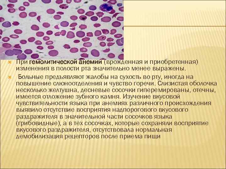  При гемолитической анемии (врожденная и приобретенная) изменения в полости рта значительно менее выражены.