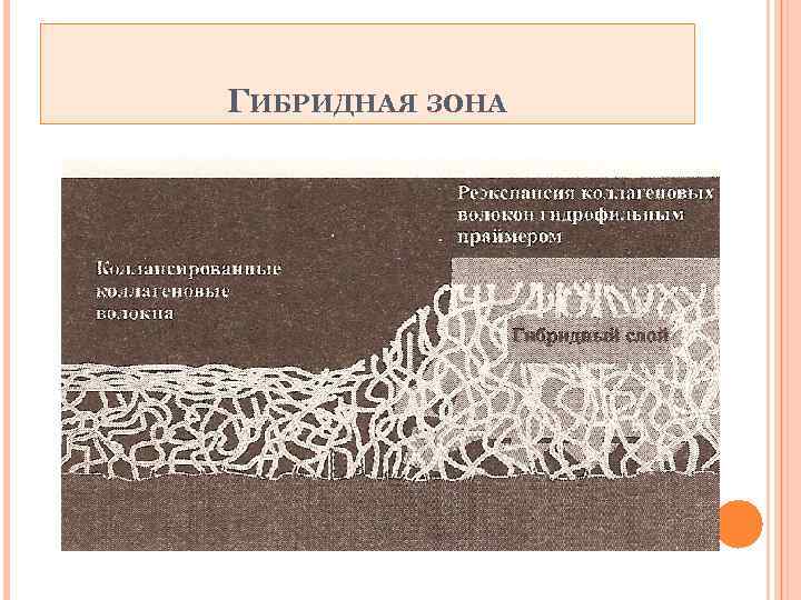 ГИБРИДНАЯ ЗОНА 