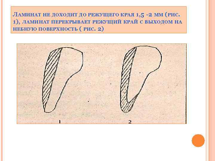 ЛАМИНАТ НЕ ДОХОДИТ ДО РЕЖУЩЕГО КРАЯ 1, 5 -2 ММ (РИС. 1), ЛАМИНАТ ПЕРЕКРЫВАЕТ