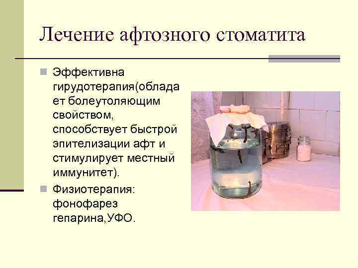 Лечение афтозного стоматита n Эффективна гирудотерапия(облада ет болеутоляющим свойством, способствует быстрой эпителизации афт и