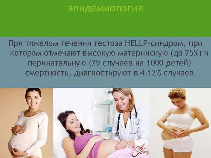 эпидемиология При тяжeлом течении гестоза НЕLLР-синдром, при котором отмечают высокую материнскую (до 75%) и