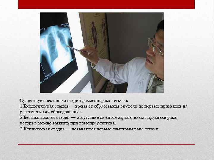 Существует несколько стадий развития рака легкого: 1. Биологическая стадия — время от образования опухоли