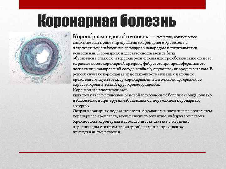 Коронарная болезнь Корона рная недоста точность — понятие, означающее снижение или полное прекращение коронарного