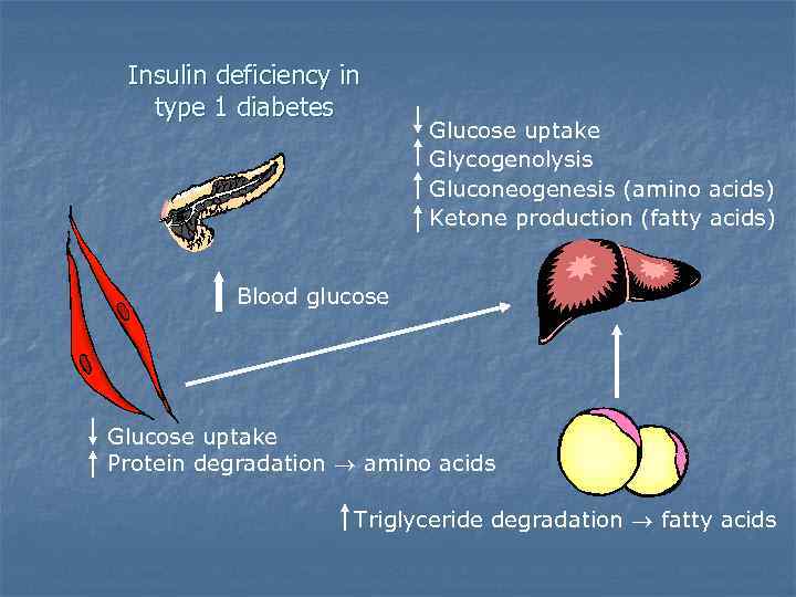 Insulin deficiency in type 1 diabetes Glucose uptake Glycogenolysis Gluconeogenesis (amino acids) Ketone production