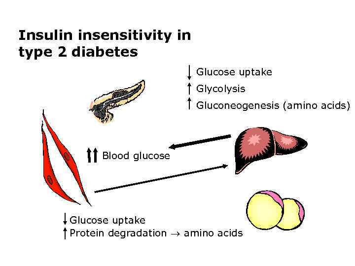Insulin insensitivity in type 2 diabetes Glucose uptake Glycolysis Gluconeogenesis (amino acids) Blood glucose