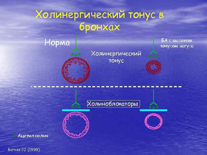 Холинергический тонус в бронхах Норма БА с высоким тонусом вагуса Холинергический тонус Холиноблокаторы Ацетилхолин