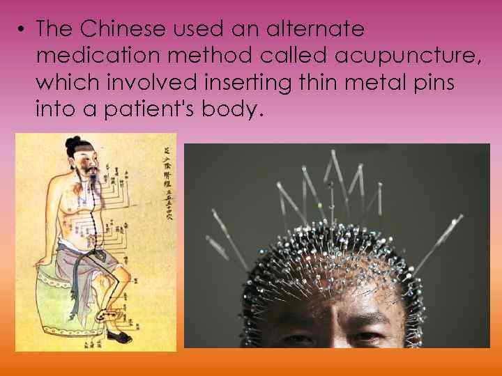  • The Chinese used an alternate medication method called acupuncture, which involved inserting