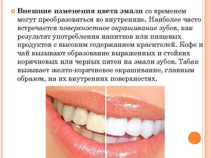  Внешние изменения цвета эмали со временем могут преобразоваться во внутренние. Наиболее часто встречается