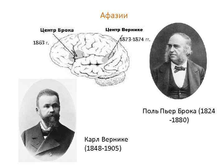 Афазии Центр Вернике 1863 г. 1873 -1874 гг. Поль Пьер Брока (1824 -1880) Карл