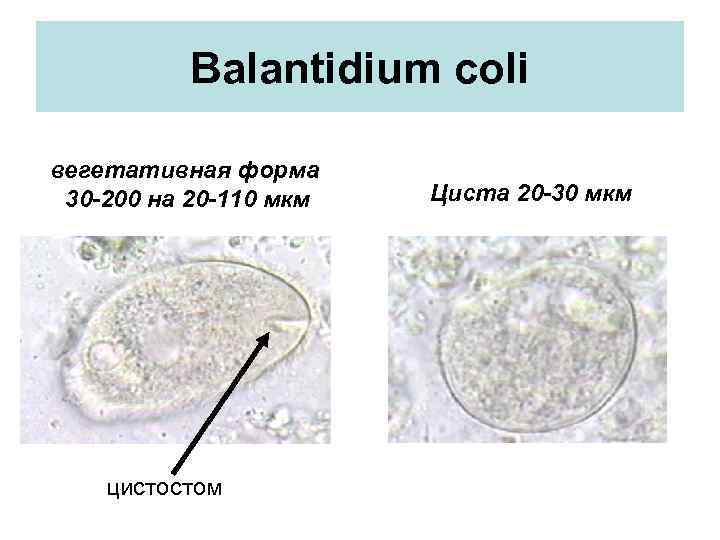 Balantidium coli вегетативная форма 30 -200 на 20 -110 мкм цистостом Циста 20 -30