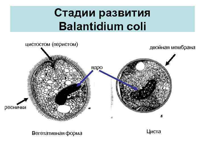 Стадии развития Balantidium coli цистостом (перистом) двойная мембрана ядро реснички Вегетативная форма Циста 
