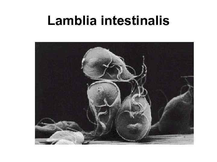 Lamblia intestinalis 