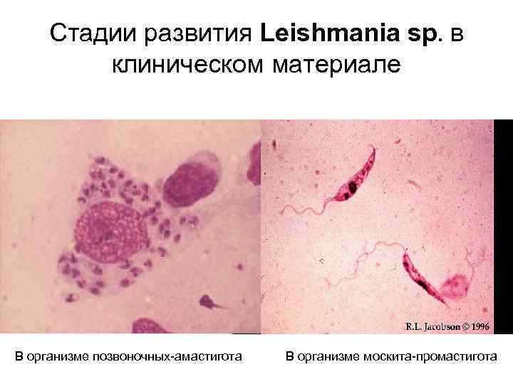 Стадии развития Leishmania sp. в клиническом материале В организме позвоночных-амастигота В организме москита-промастигота 