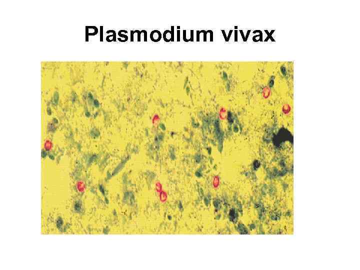 Plasmodium vivax 