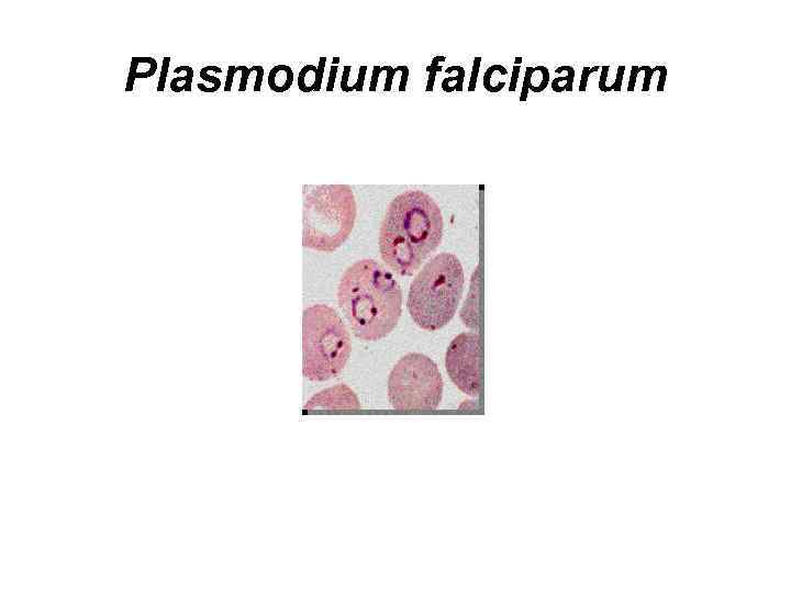 Plasmodium falciparum 