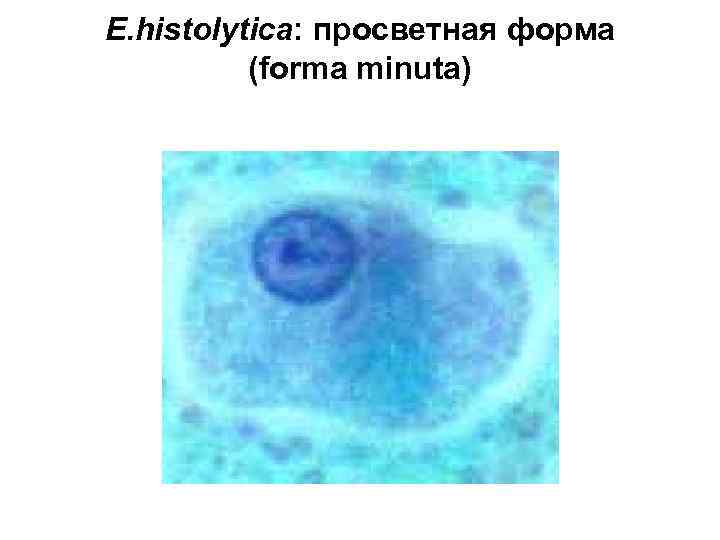 E. histolytica: просветная форма (forma minuta) 