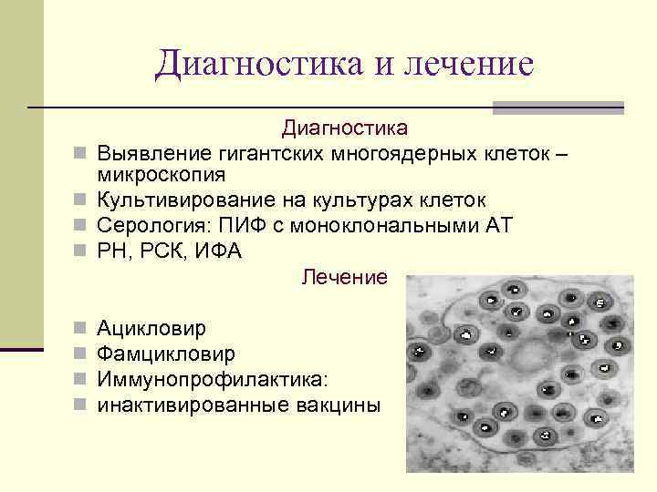 Диагностика и лечение n n n n Диагностика Выявление гигантских многоядерных клеток – микроскопия