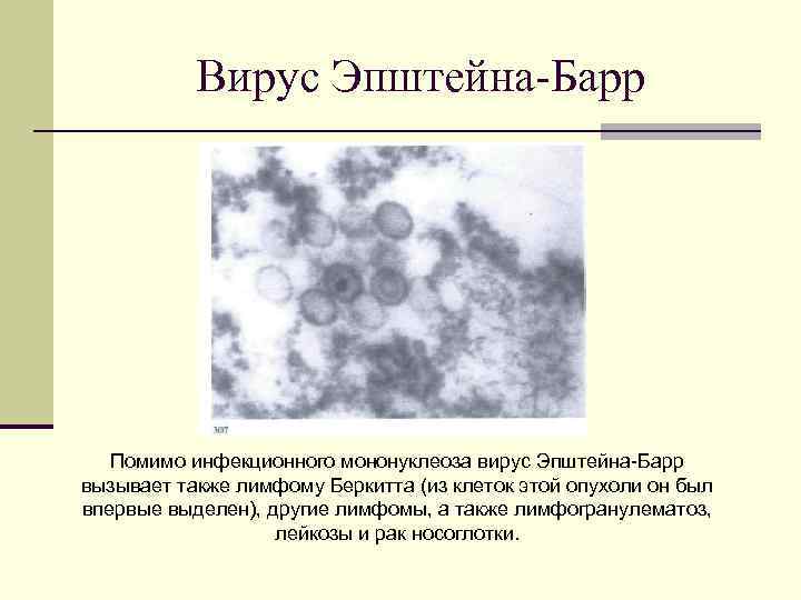 Вирус барра симптомы. Вирус Эпштейна-Барр вирусология. Клетки-мишени для вируса Эпштейн-Барра. Вирус Эпштейна-Барр ЦПД. Вирус Эпштейна-Барр вызывает.