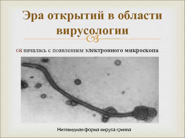 Эра открытий в области вирусологии началась с появлением электронного микроскопа Нитевидная форма вируса гриппа