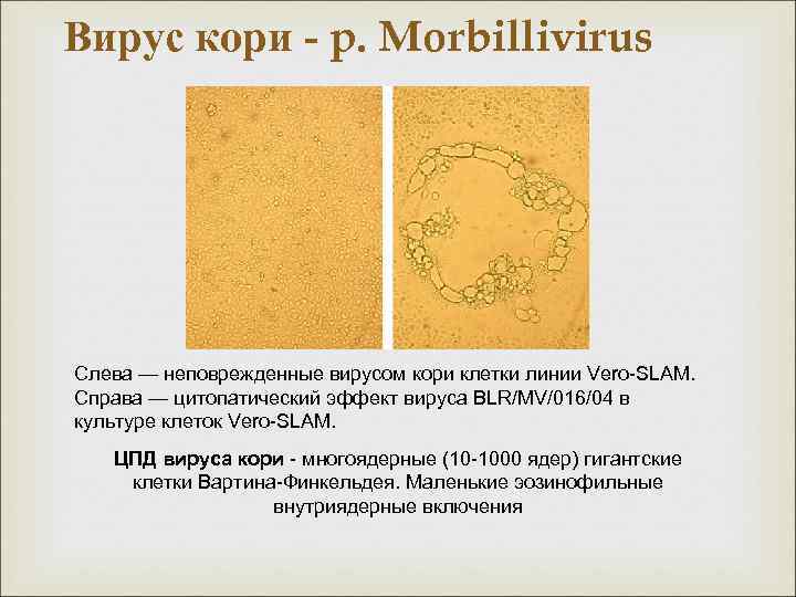 Цпд вируса это. ЦПД вирусов микробиология. Цитопатическое действие кори.