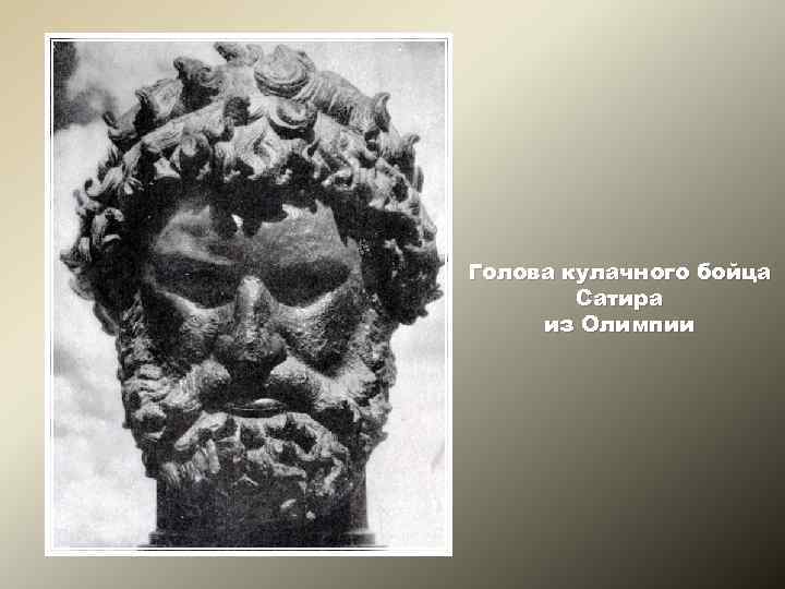 Голова кулачного бойца Сатира из Олимпии 
