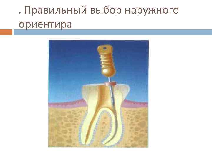 . Правильный выбор наружного ориентира 